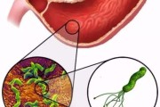 去醫院怎么檢查幽門螺旋桿菌多少錢去醫院怎么檢查幽門螺旋桿菌