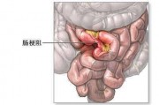 腹痛腹脹腹痛腹脹惡心消化不良