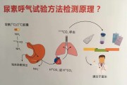 為什么不建議年輕人做碳14,為什么不建議年輕人做碳14多少錢