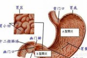 有胃炎的人能吃肉嗎？