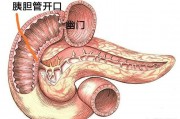 如果有十二指腸潰瘍，做了膽囊摘除術，不斷流入的膽汁會不會加重病情？