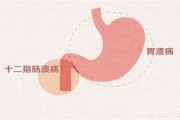 胃十二指腸球部多發息肉、非萎縮性胃炎伴糜爛嚴重嗎？