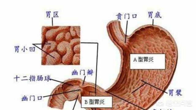 有胃炎的人能吃肉嗎<strong>胃炎</strong>？