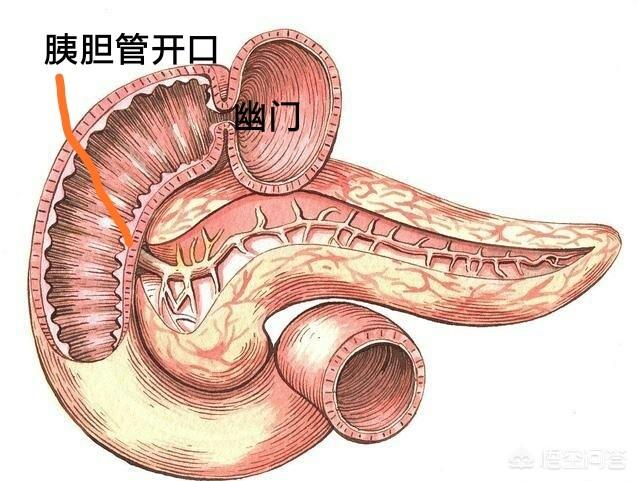 如果有十二指腸潰瘍<strong>十二指腸</strong>，做了膽囊摘除術，不斷流入的膽汁會不會加重病情？