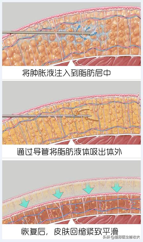 如何輕松減脂<strong>減肥</strong>？