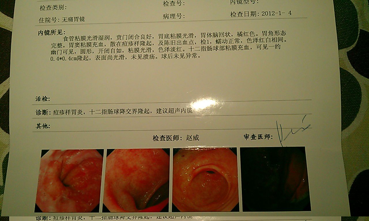 急性腸胃炎禁止喝水急性腸胃炎有些什么癥狀