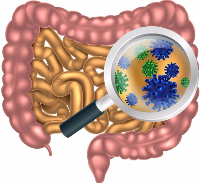 腸,腸道常見(jiàn)的六種疾病