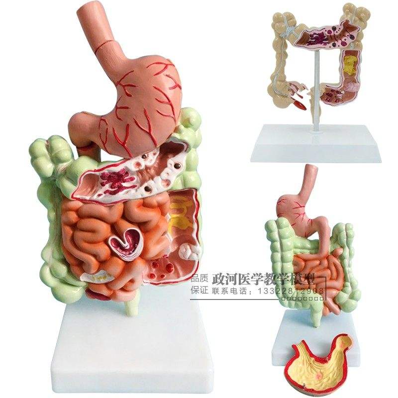 腸胃腸胃不好怎么調理