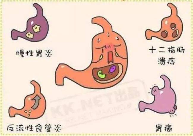 幽門螺旋桿菌陽性接吻會傳染嗎,幽門螺旋桿菌陽性會通過接吻傳染嗎